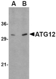 Western blot - ATG12 Antibody from Signalway Antibody (24617) - Antibodies.com