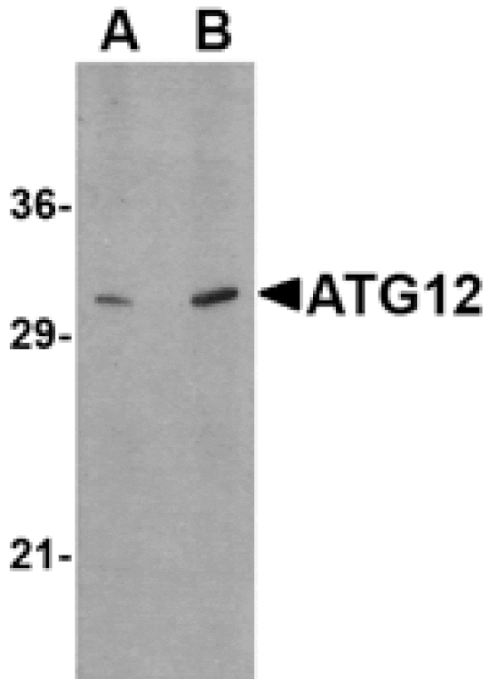 Western blot - ATG12 Antibody from Signalway Antibody (24617) - Antibodies.com