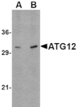 Western blot - ATG12 Antibody from Signalway Antibody (24617) - Antibodies.com