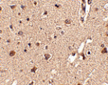 Immunohistochemistry - ATG12 Antibody from Signalway Antibody (24617) - Antibodies.com