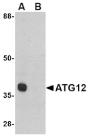 Western blot - ATG12 Antibody from Signalway Antibody (24618) - Antibodies.com