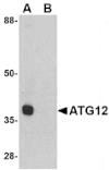 Western blot - ATG12 Antibody from Signalway Antibody (24618) - Antibodies.com