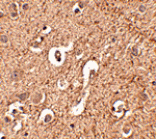 Immunohistochemistry - ATG12 Antibody from Signalway Antibody (24618) - Antibodies.com