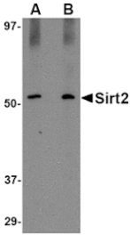 Western blot - SIRT2 Antibody from Signalway Antibody (24640) - Antibodies.com