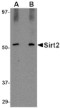 Western blot - SIRT2 Antibody from Signalway Antibody (24640) - Antibodies.com