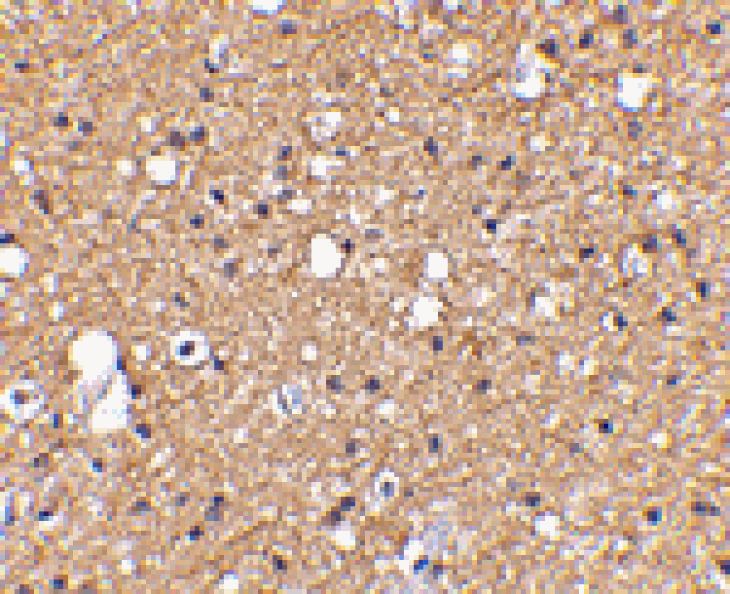Immunohistochemistry - SIRT2 Antibody from Signalway Antibody (24640) - Antibodies.com