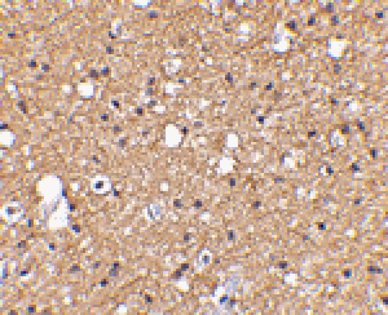 Immunohistochemistry - SIRT2 Antibody from Signalway Antibody (24640) - Antibodies.com