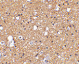 Immunohistochemistry - SIRT2 Antibody from Signalway Antibody (24640) - Antibodies.com