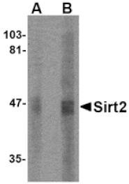 Western blot - SIRT2 Antibody from Signalway Antibody (24641) - Antibodies.com