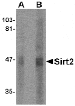 Western blot - SIRT2 Antibody from Signalway Antibody (24641) - Antibodies.com