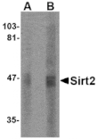 Western blot - SIRT2 Antibody from Signalway Antibody (24641) - Antibodies.com