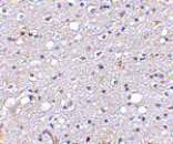 Immunohistochemistry - SIRT2 Antibody from Signalway Antibody (24641) - Antibodies.com