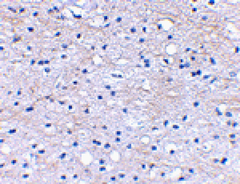 Immunohistochemistry - BRAL1 Antibody from Signalway Antibody (24646) - Antibodies.com