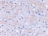 Immunohistochemistry - BRAL1 Antibody from Signalway Antibody (24646) - Antibodies.com