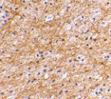 Immunohistochemistry - AIFM3 Antibody from Signalway Antibody (24658) - Antibodies.com