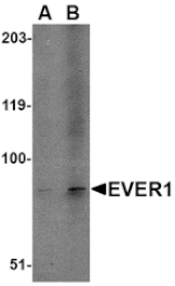Western blot - EVER1 Antibody from Signalway Antibody (24662) - Antibodies.com