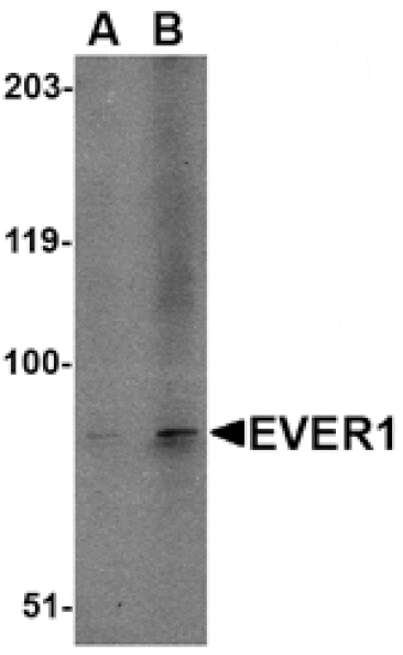 Western blot - EVER1 Antibody from Signalway Antibody (24662) - Antibodies.com