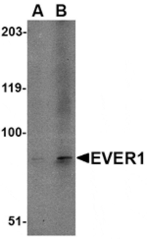 Western blot - EVER1 Antibody from Signalway Antibody (24662) - Antibodies.com