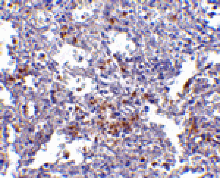 Immunohistochemistry - EVER1 Antibody from Signalway Antibody (24662) - Antibodies.com