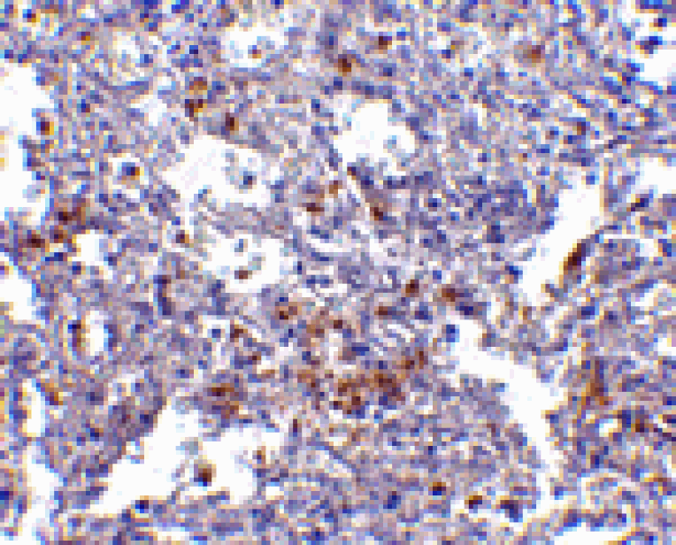 Immunohistochemistry - EVER1 Antibody from Signalway Antibody (24662) - Antibodies.com