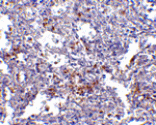 Immunohistochemistry - EVER1 Antibody from Signalway Antibody (24662) - Antibodies.com