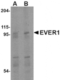 Western blot - EVER1 Antibody from Signalway Antibody (24663) - Antibodies.com