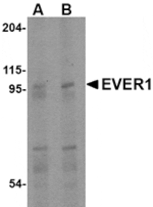 Western blot - EVER1 Antibody from Signalway Antibody (24663) - Antibodies.com