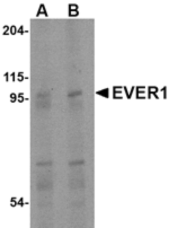 Western blot - EVER1 Antibody from Signalway Antibody (24663) - Antibodies.com