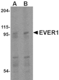 Western blot - EVER1 Antibody from Signalway Antibody (24663) - Antibodies.com