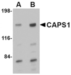 Western blot - CAPS1 Antibody from Signalway Antibody (24668) - Antibodies.com