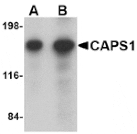 Western blot - CAPS1 Antibody from Signalway Antibody (24669) - Antibodies.com