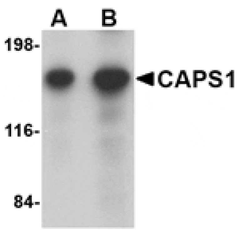 Western blot - CAPS1 Antibody from Signalway Antibody (24669) - Antibodies.com