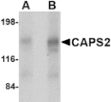 Western blot - CAPS2 Antibody from Signalway Antibody (24670) - Antibodies.com