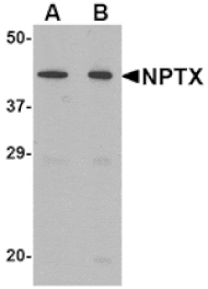 Western blot - NPTX2 Antibody from Signalway Antibody (24673) - Antibodies.com