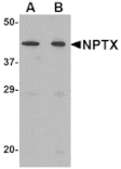 Western blot - NPTX2 Antibody from Signalway Antibody (24673) - Antibodies.com