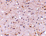 Immunohistochemistry - NPTX2 Antibody from Signalway Antibody (24673) - Antibodies.com