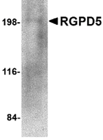 Western blot analysis of RGPD5 in human thymus tissue lysate with RGPD5 antibody at 1 µg/mL.