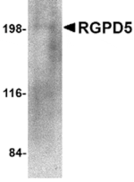 Western blot - RGPD5 Antibody from Signalway Antibody (24674) - Antibodies.com