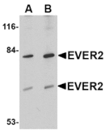 Western blot - EVER2 Antibody from Signalway Antibody (24683) - Antibodies.com