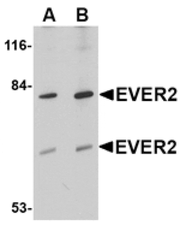 Western blot - EVER2 Antibody from Signalway Antibody (24683) - Antibodies.com