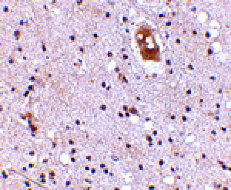 Immunohistochemistry - EVER2 Antibody from Signalway Antibody (24683) - Antibodies.com