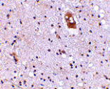 Immunohistochemistry - EVER2 Antibody from Signalway Antibody (24683) - Antibodies.com