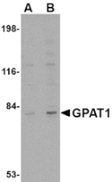 Western blot - GPAT1 Antibody from Signalway Antibody (24687) - Antibodies.com