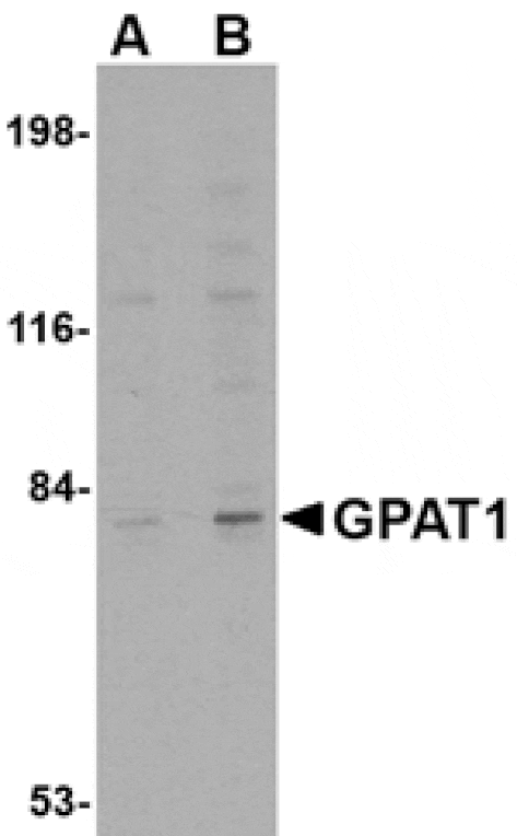 Western blot - GPAT1 Antibody from Signalway Antibody (24687) - Antibodies.com