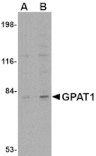 Western blot - GPAT1 Antibody from Signalway Antibody (24687) - Antibodies.com