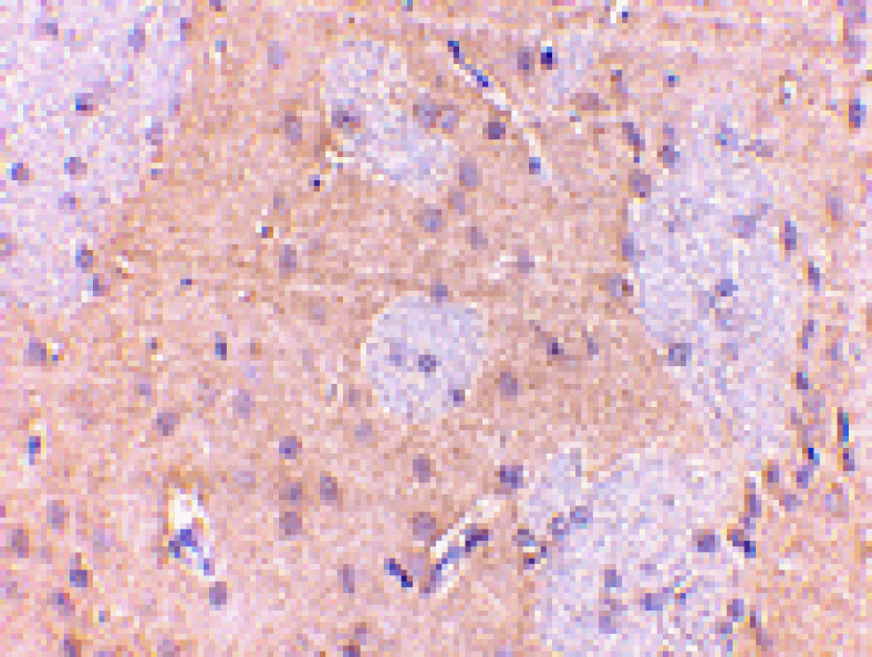 Immunohistochemistry - GPAT1 Antibody from Signalway Antibody (24687) - Antibodies.com