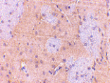 Immunohistochemistry - GPAT1 Antibody from Signalway Antibody (24687) - Antibodies.com