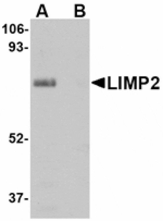 Western blot - LIMP2 Antibody from Signalway Antibody (24691) - Antibodies.com