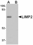 Western blot - LIMP2 Antibody from Signalway Antibody (24691) - Antibodies.com