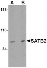 Western blot - SATB2 Antibody from Signalway Antibody (24694) - Antibodies.com